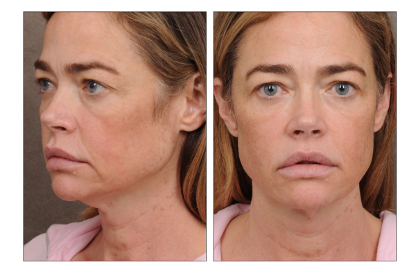 Image may contain Head Person Face Adult Body Part Neck Photography and Portrait